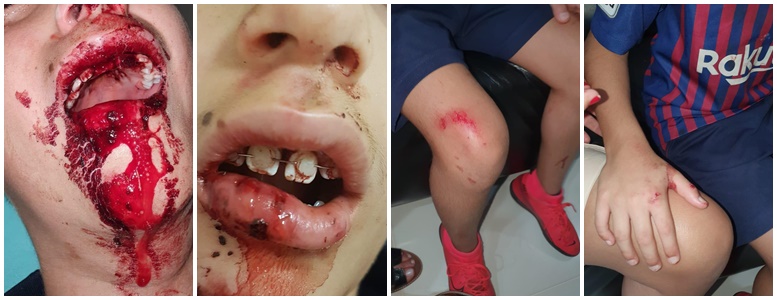 Briga entre crianças de 9 anos assusta os moradores do Damha II. Menor foi agredido por motivo fútil